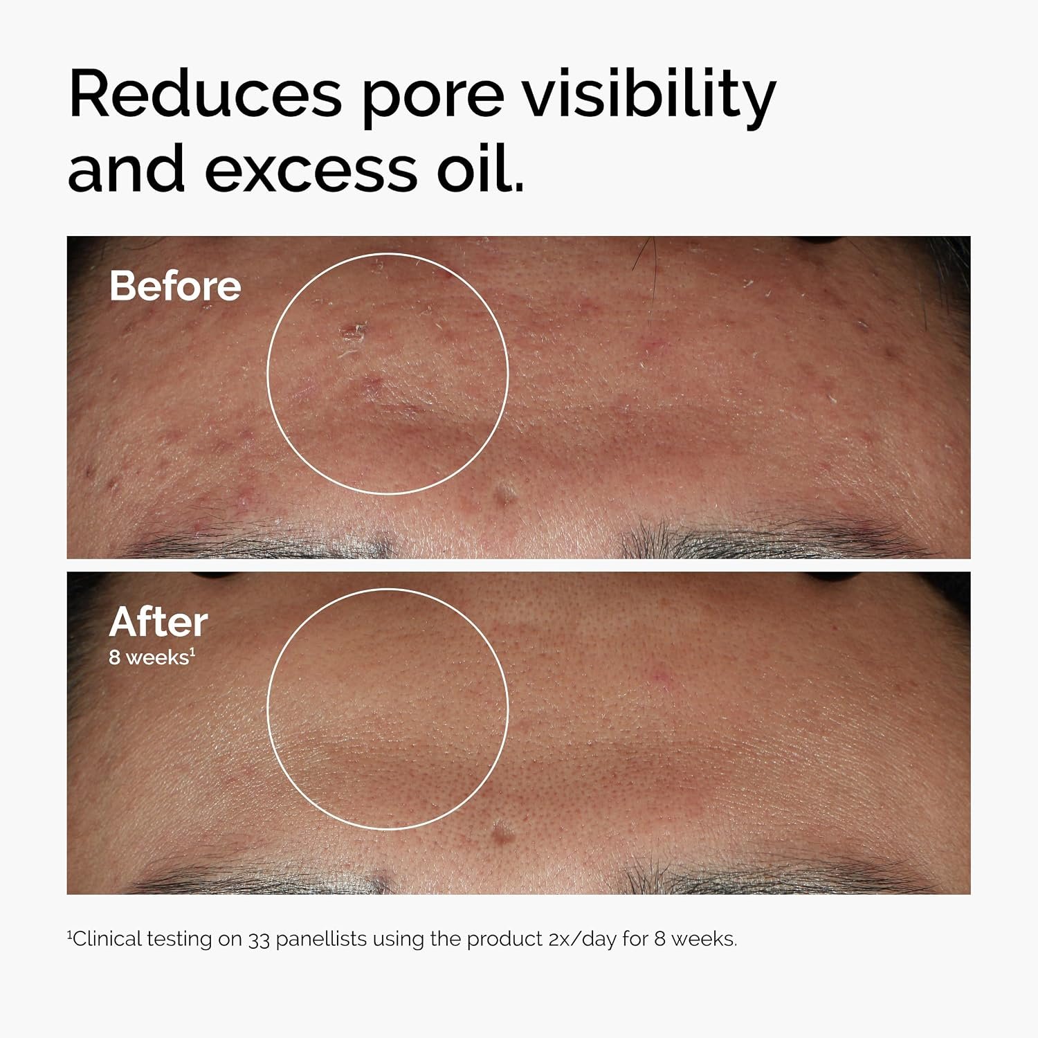 The $12 Serum That Actually Shrank My Pores